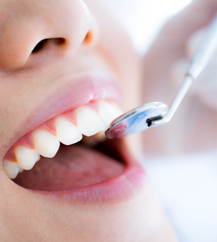 clinique-dentaire-nicolas-beaudoin-service-dentisterie-generale